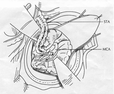 Figure 17